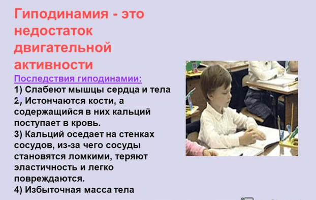 Гиподинамия