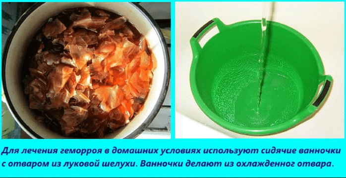 Ванна с настоем лука