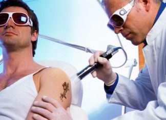 Існує кілька сучасних методів видалення тату