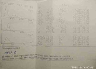 Аналіз крові. Мікроцитоз.