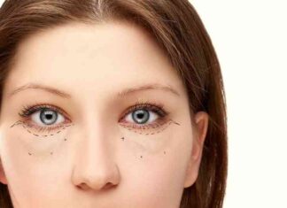 Малярні мішки під очима: причини і як позбутися