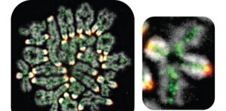 Il processo nascosto dietro l’aborto spontaneo, la sindrome di Down e l’infertilità