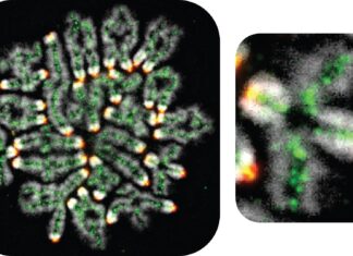 Приховані механізми викиднів, синдрому Дауна та безпліддя