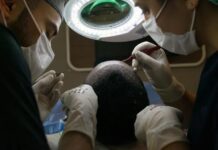 Як впоратися з витонченням волосся: варіанти, причини та реалістичні очікування