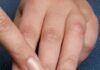 Redenen waarom nagels broos worden en hoe je ze kunt repareren