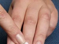 Reasons why nails become brittle and how to fix them