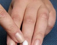 Redenen waarom nagels broos worden en hoe je ze kunt repareren